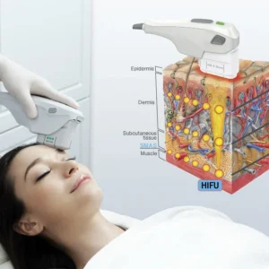 Introduction to HIFU Skin Tightening & Rejuvenation (Includes Certificate)