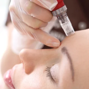 Introductory Skin Needling Masterclass (Includes Certificate)
